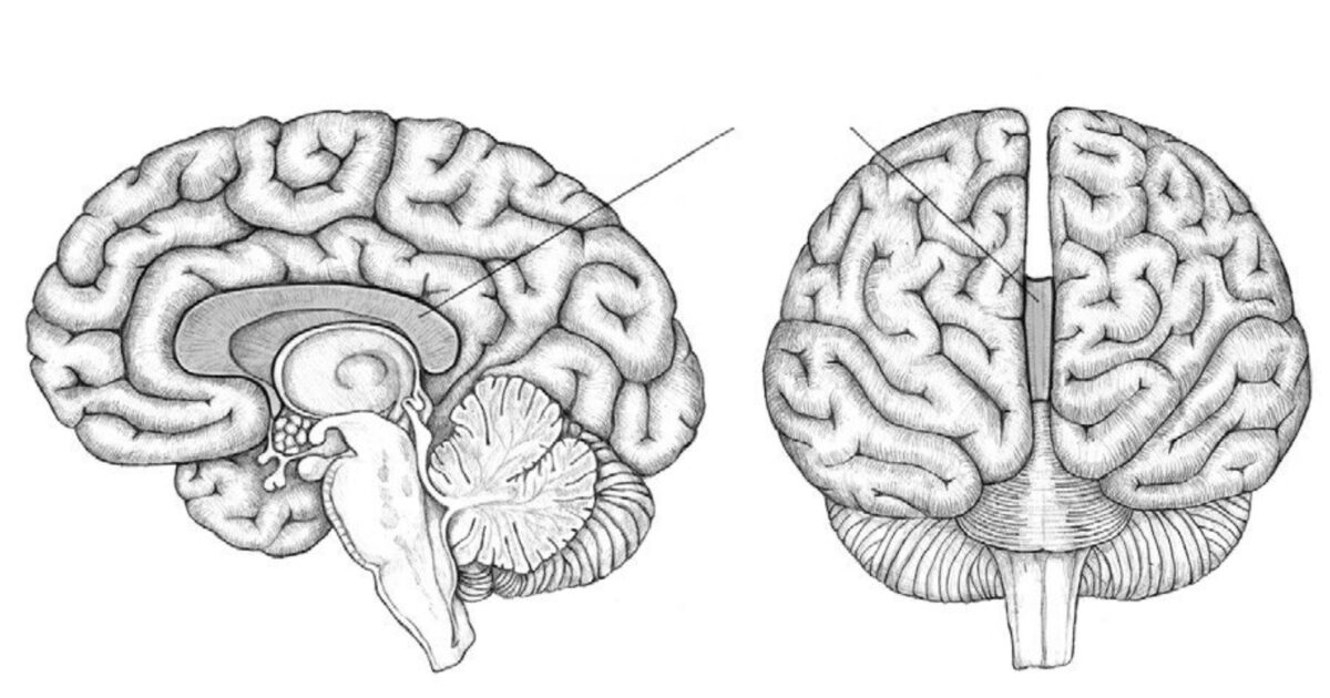 Мозолистое тело. Анатомия мозолистого тела головного мозга. Мозолистое тело Corpus callosum. Большие полушария головного мозга мозолистое тело. Мозолистое тело мозжечок.